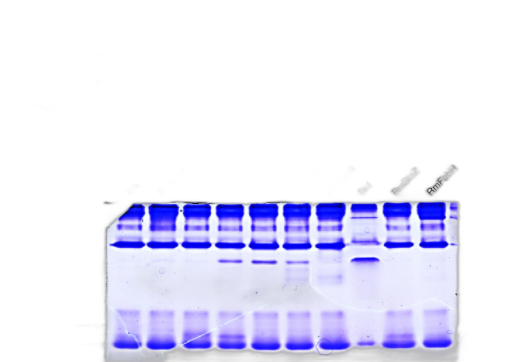 ACP TABS 30'S